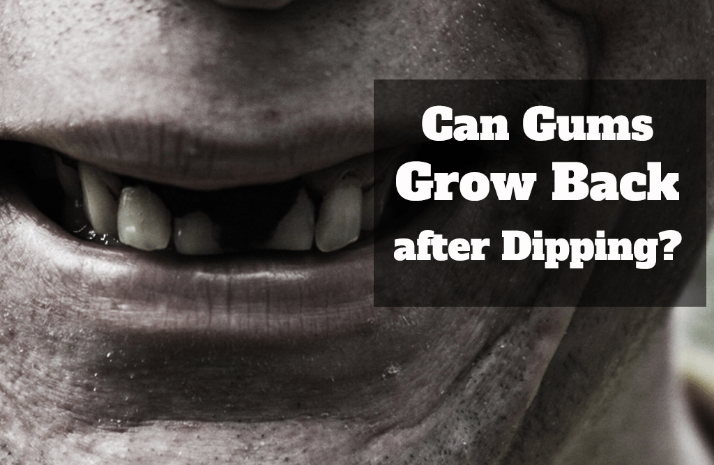 Can gums grow back?